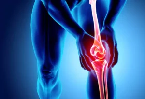 Rheumatoid Arthritis Treatment Specialist