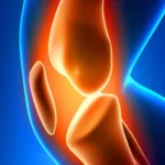 DrAniketPatil-Robotic-Knee-Surgery-PunePCMC